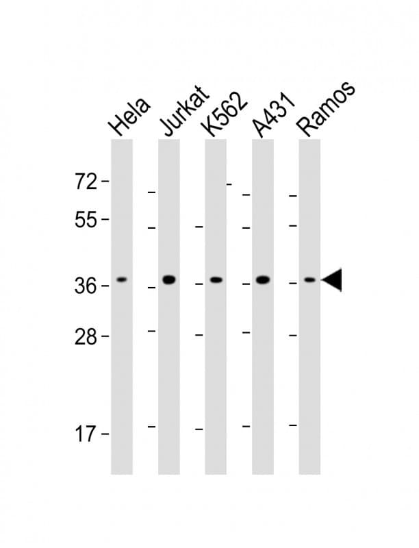 RAD51 / RECA Antibody (clone 1690CT417.18.80)