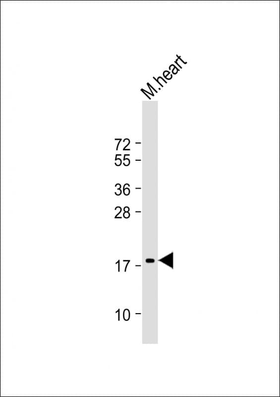 NPPA / ANP Antibody (clone 1761CT158.12.76)