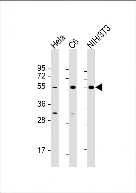 Monoclonal Mouse anti-Human PTEN Antibody (clone 1096CT4.3.3, N-Terminus, WB)
