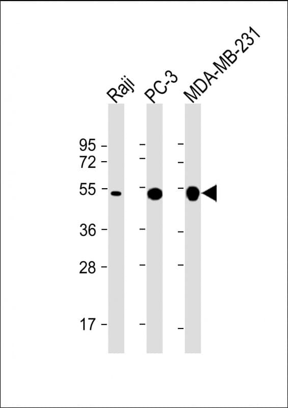 MMP1 Antibody (clone 1054CT20.4.3)