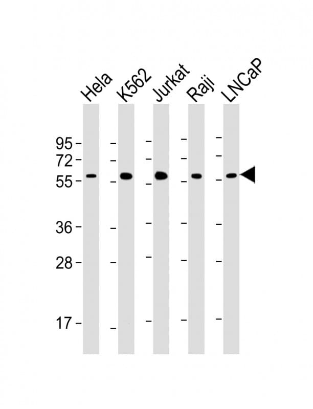 MYC / c-Myc Antibody (clone 1788CT320.61.28)