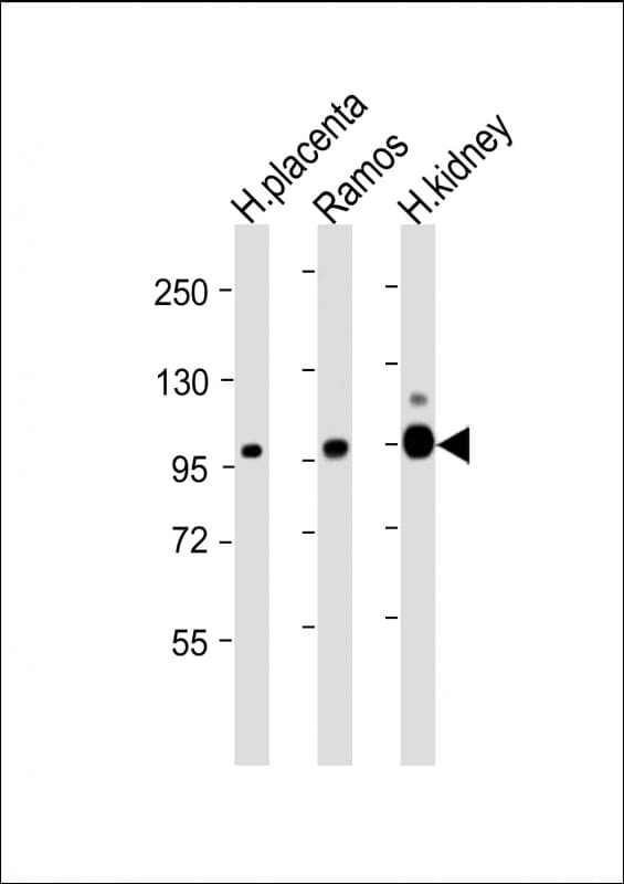MME / CD10 Antibody (Internal, clone 965CT9.1.1)