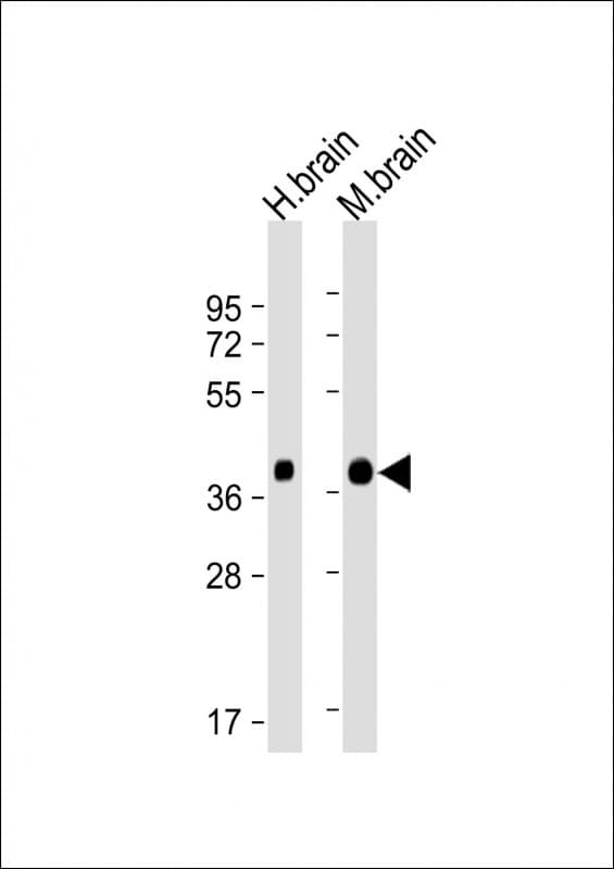 Monoclonal Mouse anti-Human SYP / Synaptophysin Antibody (clone 701CT23.9.8, C-Terminus, WB)