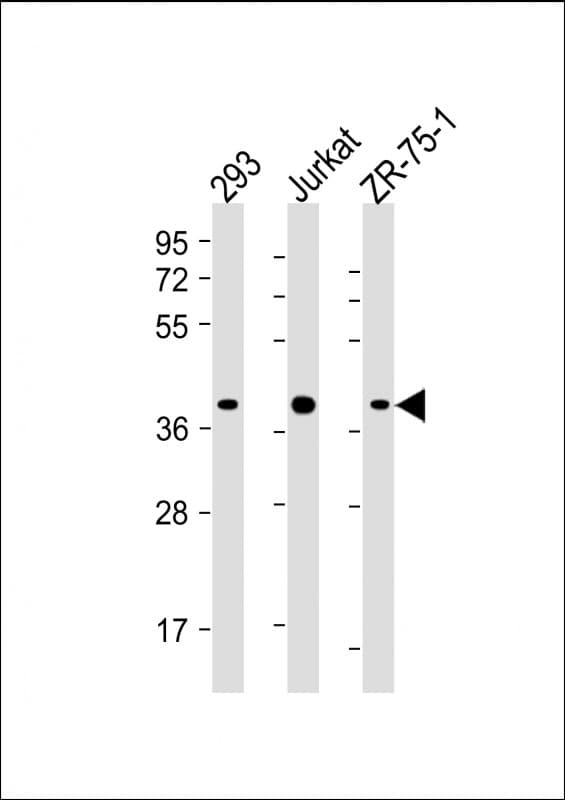 HIF1AN Antibody (C-Terminus, clone 931CT3.1.1)