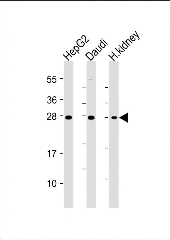 HAVCR2 / TIM-3 Antibody (clone 1827CT151.74.68)