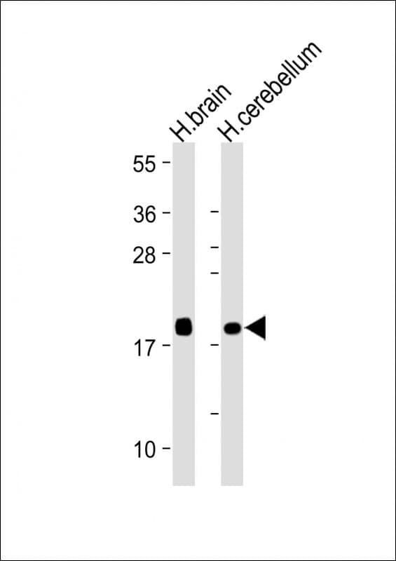 VILIP / VSNL1 Antibody (clone 1831CT148.68.34)