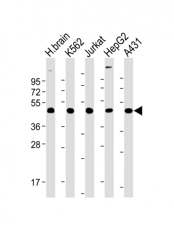 Monoclonal Mouse anti-Human TSG101 Antibody (clone 1883CT788.47.15.46, WB)