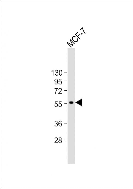 CYP27B1 Antibody (C-Terminus, clone 1981CT820.303.81)