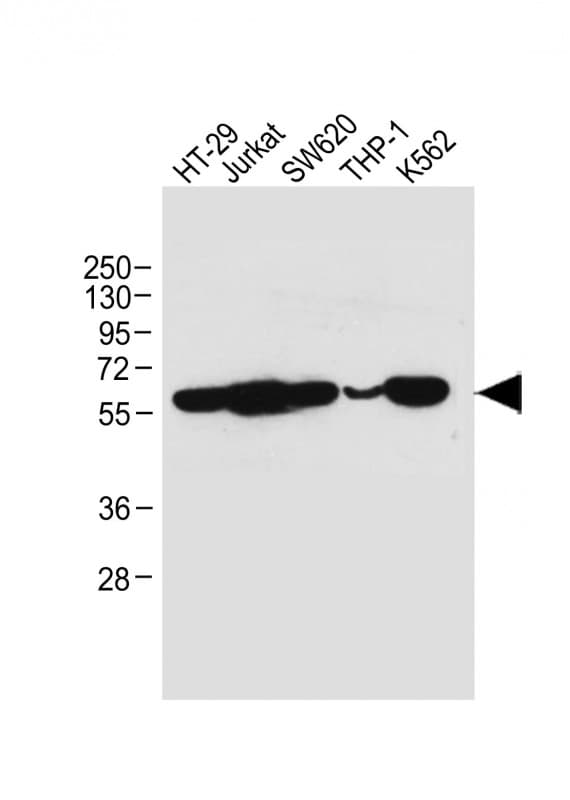 RIPK3 / RIP3 Antibody (clone 2013CT892.86.49)