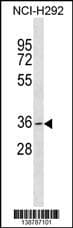 Polyclonal Rabbit anti-Human GDF5OS Antibody (aa 206-232, C-term, WB)