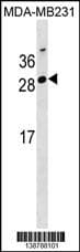 Polyclonal Rabbit anti-Human GG2L4 Antibody (aa 45-72, Internal, WB)