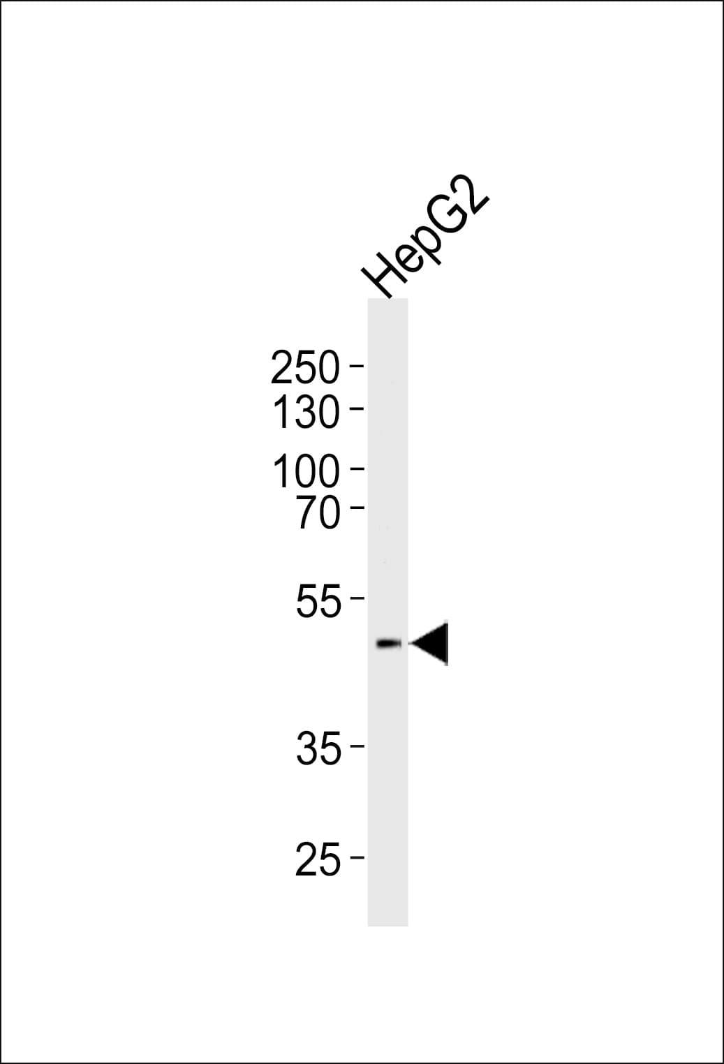 Polyclonal Rabbit anti-Human HHCM Antibody (aa 341-368, C-term, WB)