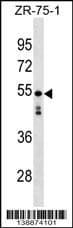 KRT87P Antibody (aa 96-122, N-term)