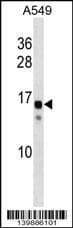 SSX11 Antibody (aa 1-30, N-term)
