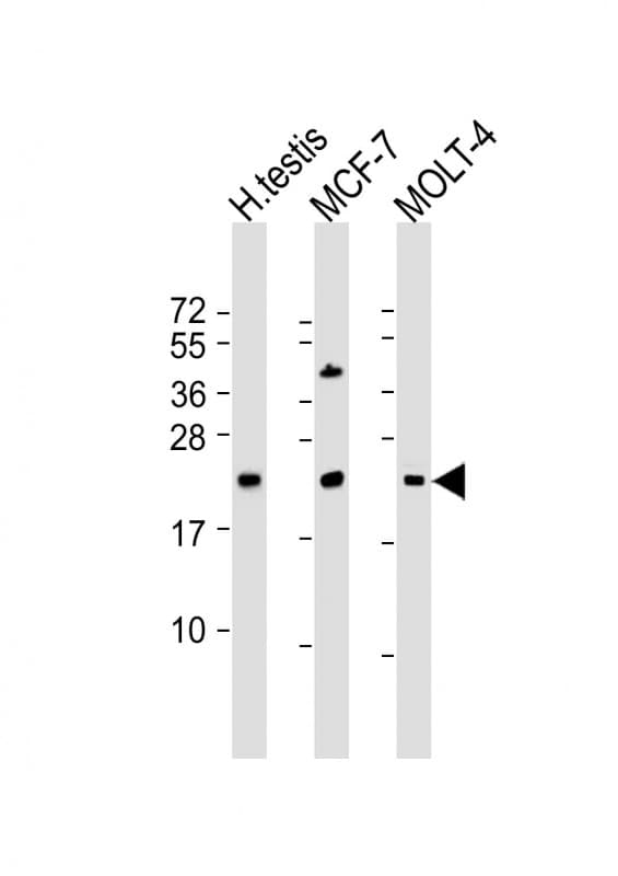 STAG3L1 Antibody (aa 108-136, Internal)