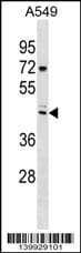 TRIX3 Antibody (aa 41-67, N-term)