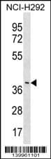 LRRC74B Antibody (aa 355-383, C-term)