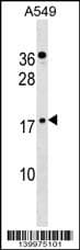 Polyclonal Rabbit anti-Human ZNF663 Antibody (aa 64-91, C-term, WB)
