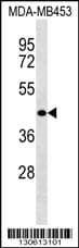 Polyclonal Rabbit anti-Human WASH2P Antibody (aa 1-30, N-term, WB)