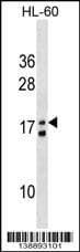 MGAT4EP Antibody (aa 56-82, Internal)