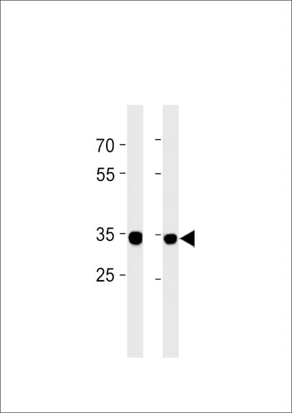 RPLP0P6 Antibody (aa 1-30, N-term)
