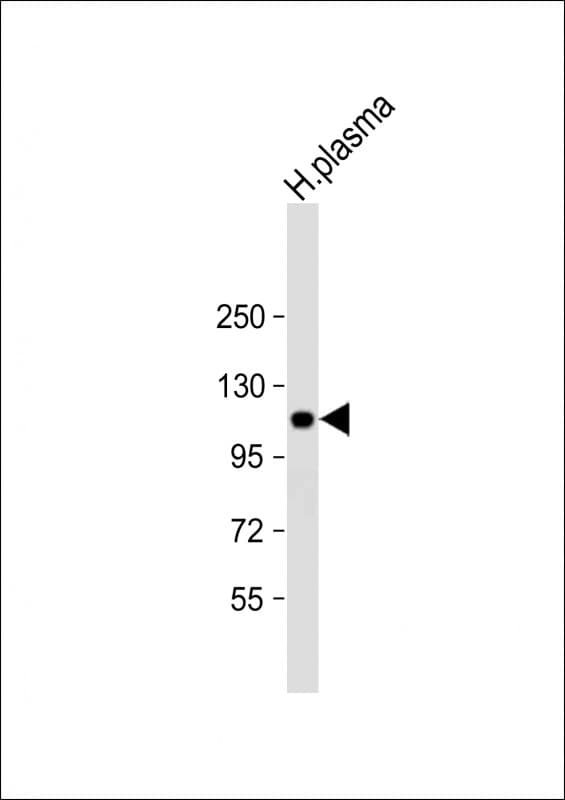 Polyclonal Rabbit anti-Human ITIH4 Antibody (aa784-816, IF, WB)