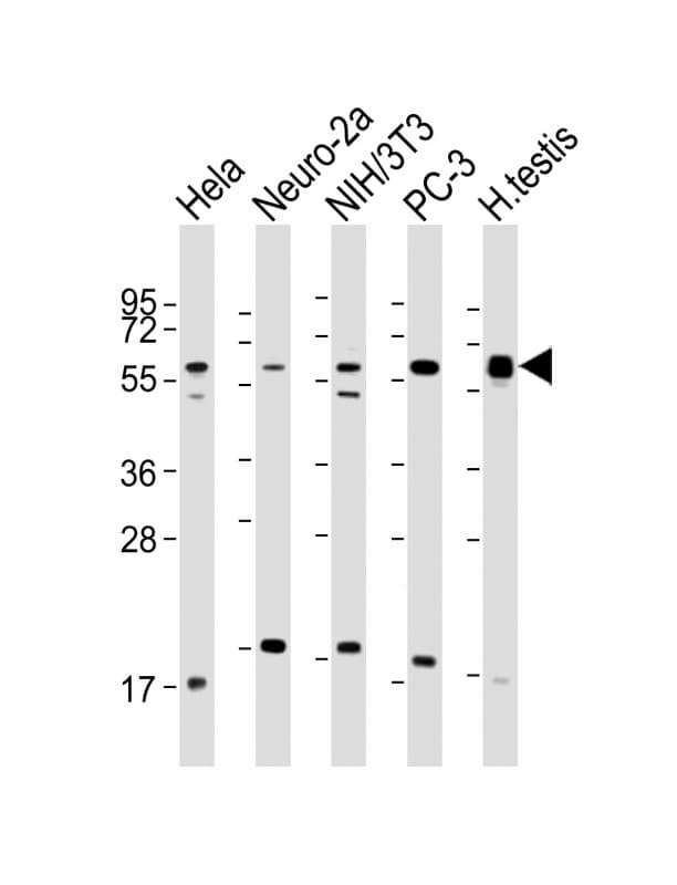Polyclonal Rabbit anti-Human TRXR1 / TXNRD1 Antibody (C-Terminus, WB)