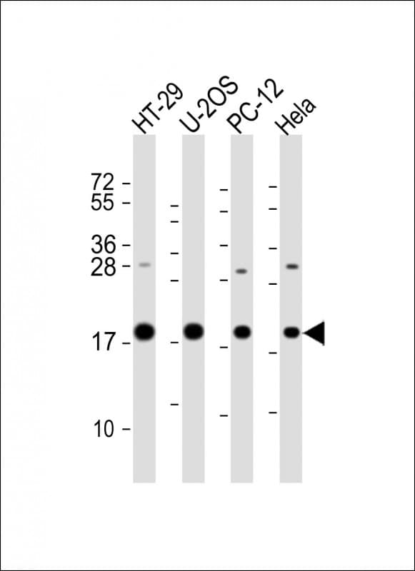 STMN1 / Stathmin / LAG Antibody (C-Terminus)