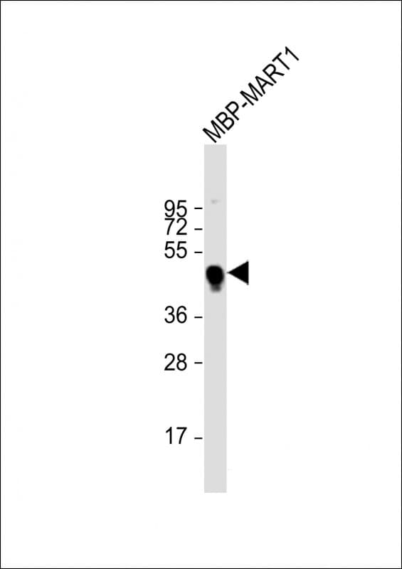 Polyclonal Rabbit MBP Tag Antibody (WB)