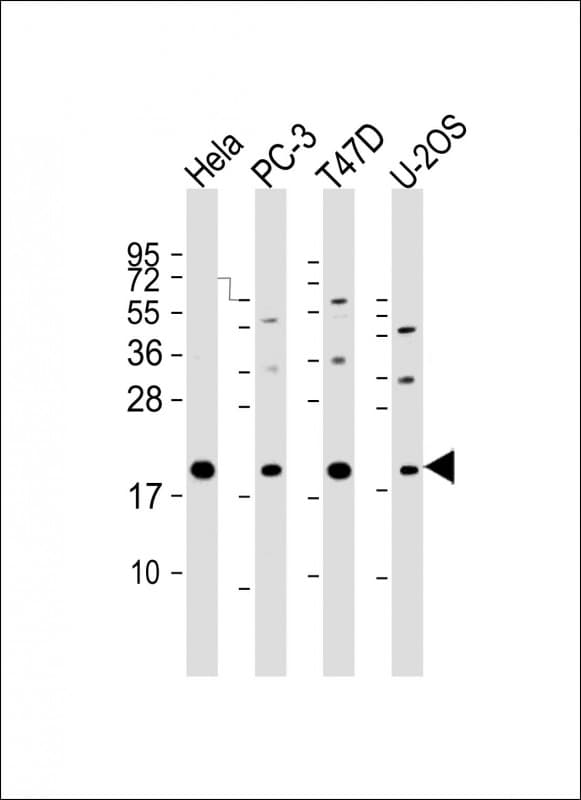 Polyclonal Rabbit anti-Human ANAPC11 / APC11 Antibody (C-Terminus, WB)