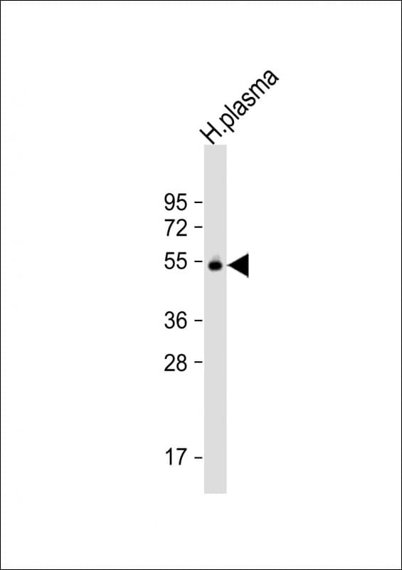 Polyclonal Rabbit anti-Human GC / Vitamin D-Binding Protein Antibody (N-Terminus, WB)