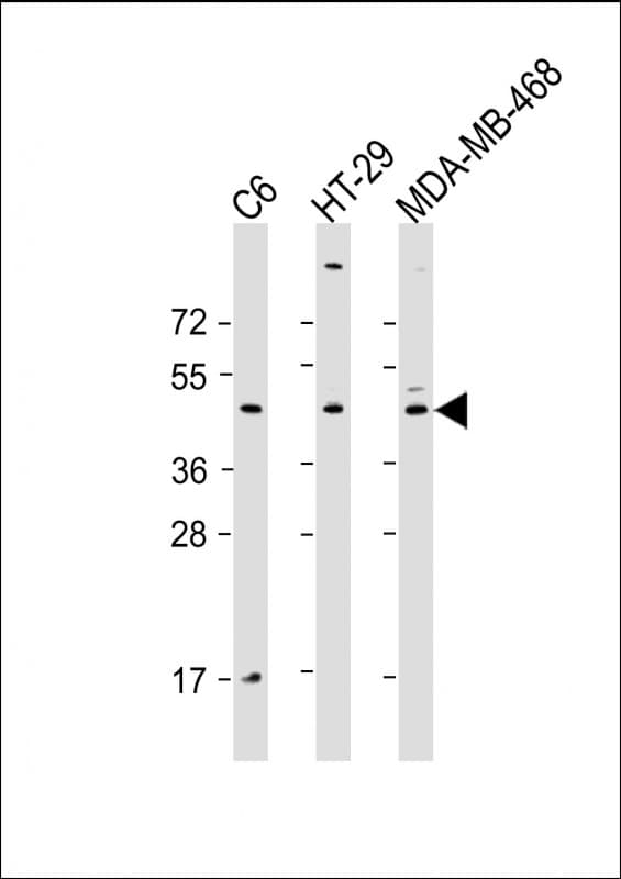 Polyclonal Rabbit anti-Human GSK3B / GSK3 Beta Antibody (Ser9, WB)