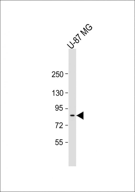 Polyclonal Rabbit anti-Human PLAA Antibody (Internal, WB)