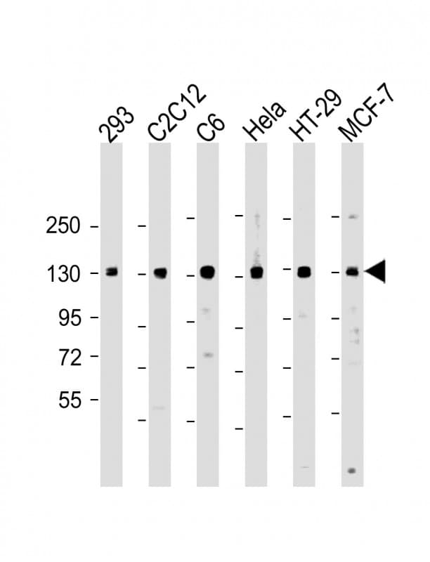Polyclonal Rabbit anti-Human PPP1R12A / MYPT1 Antibody (WB)