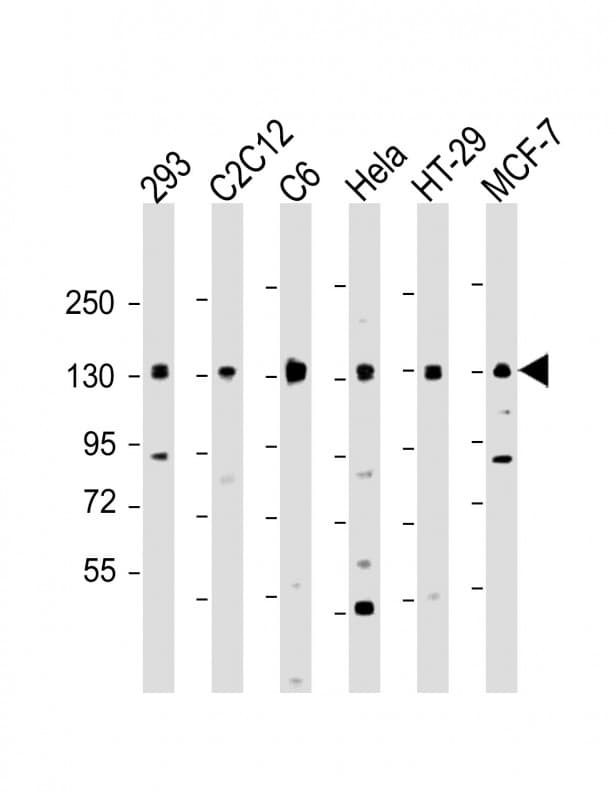 Polyclonal Rabbit anti-Human PPP1R12A / MYPT1 Antibody (WB)