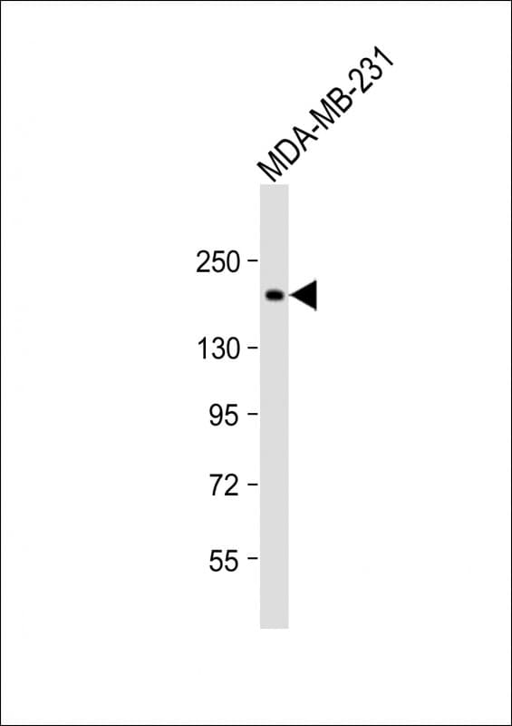 Polyclonal Rabbit anti-Human THBS1 / Thrombospondin-1 Antibody (C-Terminus, WB)