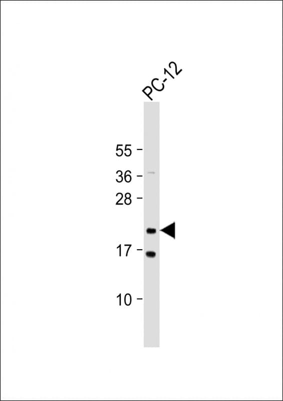 Polyclonal Rabbit anti-Human NRAS / N-ras Antibody (IHC, WB)