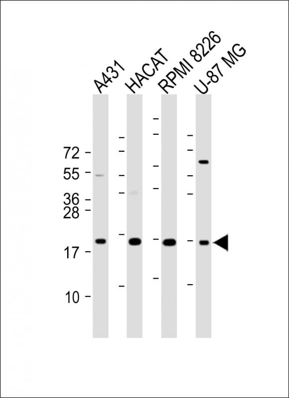 TGFA / TGF Alpha Antibody (C-Terminus)