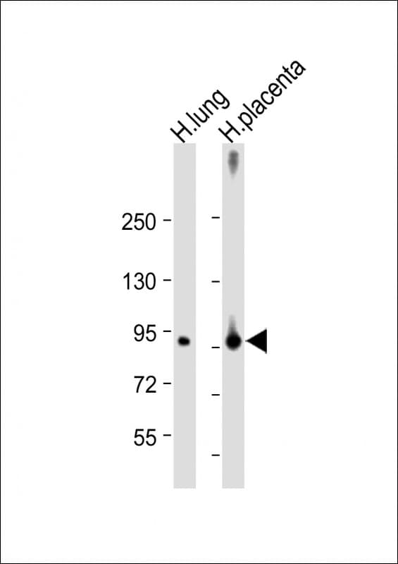 Polyclonal Rabbit anti-Human F13A1 / Factor XIIIa Antibody (N-Terminus, WB)