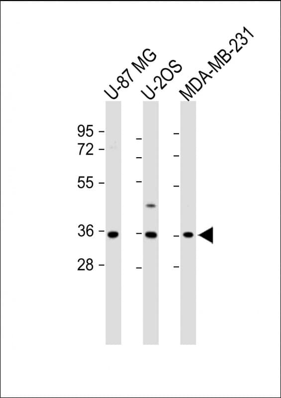 Polyclonal Rabbit anti-Human OR2AE1 Antibody (C-Terminus, WB)