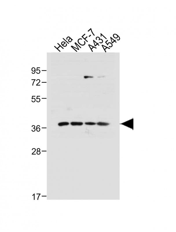 Polyclonal Rabbit anti-Human CDK7 Antibody (WB)