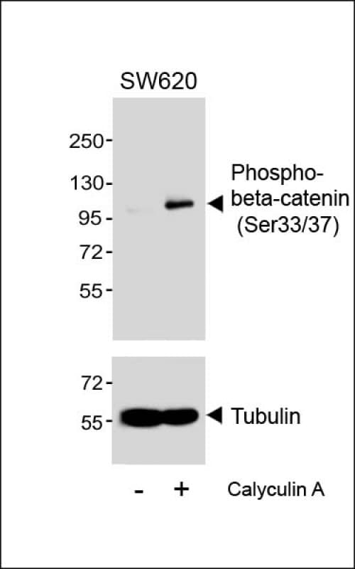 CTNNB1 / Beta Catenin Antibody (phospho-Ser33/37)