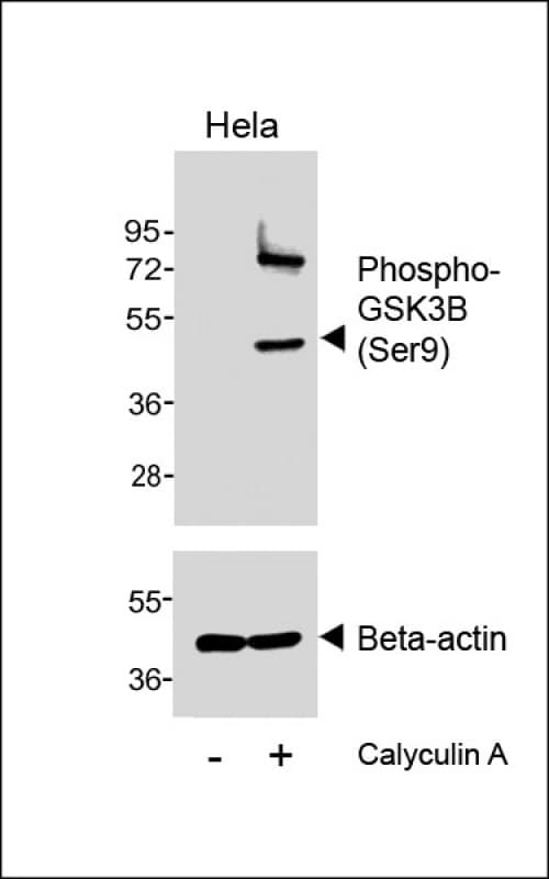 Polyclonal Rabbit anti-Human GSK3B / GSK3 Beta Antibody (phospho-Ser9, WB)
