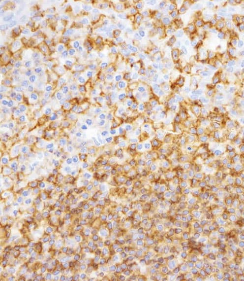 Monoclonal Mouse anti-Human CD45 / LCA Antibody (IHC, WB)