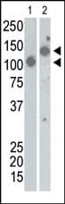 SARS-CoV Spike Glycoprotein Antibody (aa 13-42)