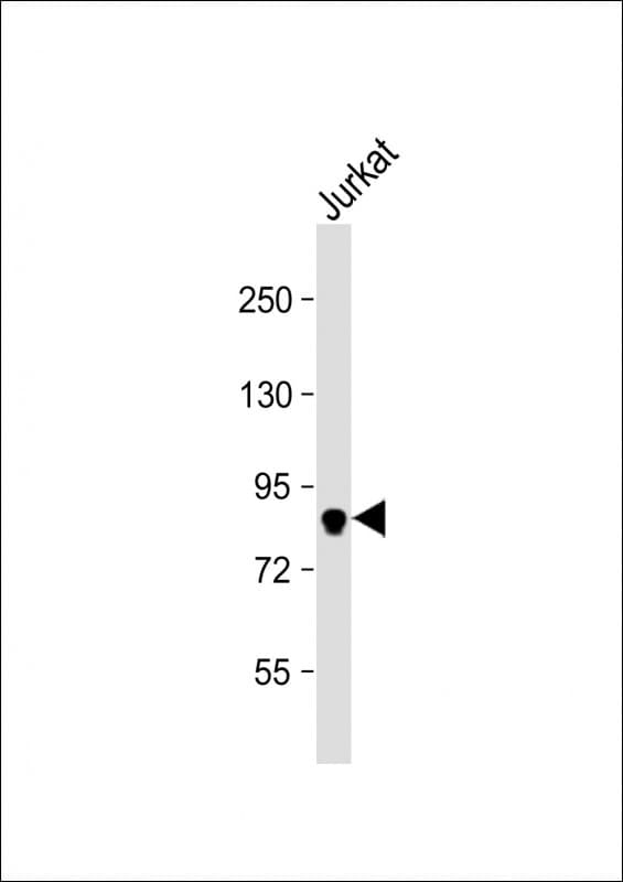 Polyclonal Rabbit anti-Human MLH1 Antibody (C-Terminus, WB)