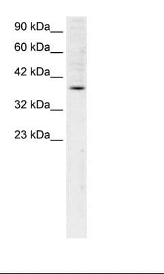 Polyclonal Rabbit anti-Human FOSB Antibody (HRP, aa240-289, IHC, WB)