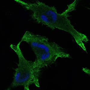 Monoclonal Mouse anti-Human JUP/CTNNG/Junction Plakoglobin Antibody (clone 4C12, IHC, IF, WB)