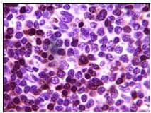 ZAP70 Antibody (clone 3D2A4)