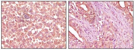 EPHA2 / EPH Receptor A2 Antibody (clone 1B3C7)